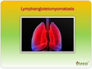 Lymphangioleiomyomatosis: Causes, Symptoms, Daignosis, Prevention and Treatment