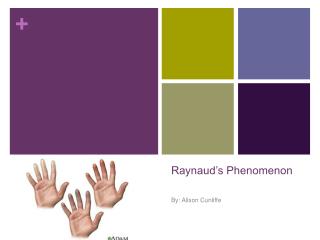 Raynaud’s Phenomenon