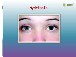Mydriasis: Causes, Symptoms, Daignosis, Prevention and Treatment