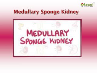 Medullary Sponge Kidney: Causes, Symptoms, Daignosis, Prevention and Treatment