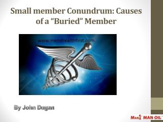 Small member Conundrum: Causes of a â€œBuriedâ€ Member