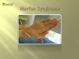 Marfan Syndrome: Causes, Symptoms, Daignosis, Prevention and Treatment