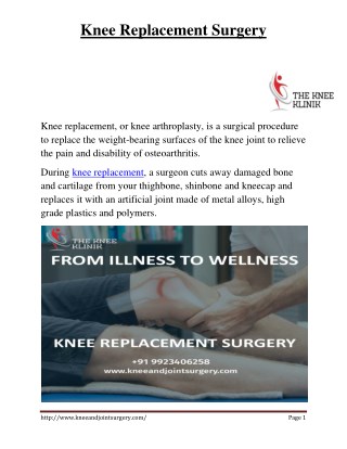 PDF | Best Knee Replacement Surgery in Pune by Dr Anshu Sachdev