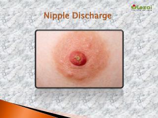 Nipple Discharge: Causes, Symptoms, Daignosis, Prevention and Treatment