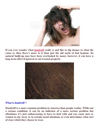 for dandruff treatment for homemade-how to dandruff treatment