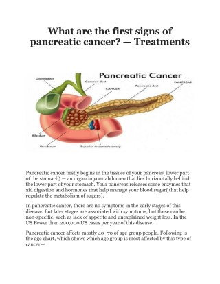 What are the first signs of pancreatic cancer?- Treatments