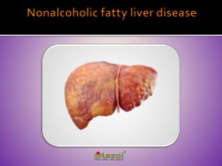 Nonalcoholic fatty liver: Causes, Symptoms, Daignosis, Prevention and Treatment