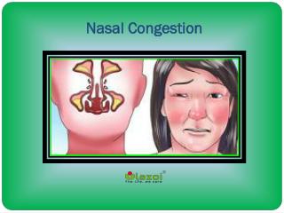 Nasal Congestion: Causes, Symptoms, Diagnosis and Treatment