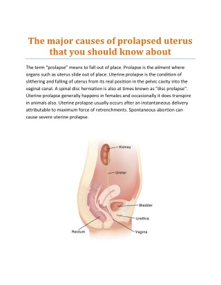 Herbal treatment of uterus prolapsed