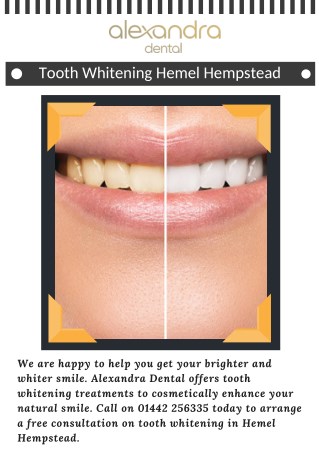 Tooth Whitening Hemel Hempstead