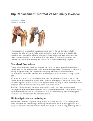 Hip Replacement: Normal Vs Minimally Invasive