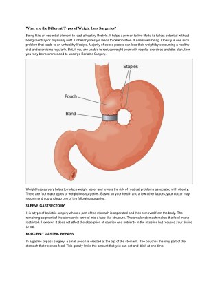 What are the Different Types of Weight Loss Surgeries?