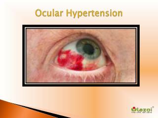Ocular Hypertension: Causes, Symptoms, Daignosis, Prevention and Treatment