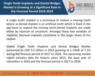 Global Single Tooth Implants and Dental Bridges Market â€“ Industry Trends and Forecast to 2024