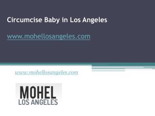 Circumcise Baby in Los Angeles - www.mohellosangeles.com