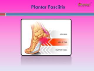 Plantar Fasciitis: Causes, Symptoms, Daignosis, Prevention and Treatment