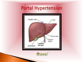 Portal Hypertension: Causes, Symptoms, Daignosis, Prevention and Treatment