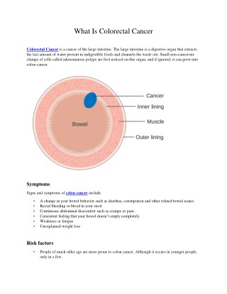 What Is Colorectal Cancer