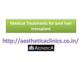 Medical treatments for best hair transplant