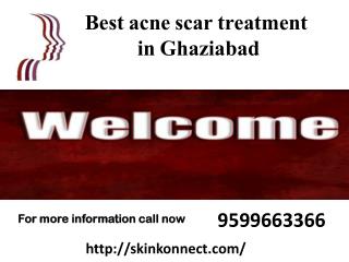 Best Pimple Treatment in Ghaziabad
