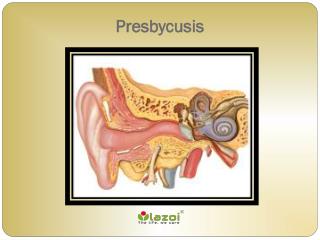 Presbycusis: Causes, Symptoms, Daignosis, Prevention and Treatment