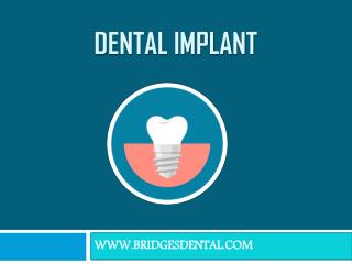 How Dental Implant Save Your Smile | Brandon Dentist