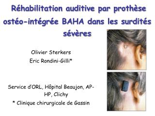 Réhabilitation auditive par prothèse ostéo-intégrée BAHA dans les surdités sévères