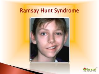 Ramsay Hunt Syndrome: Causes, Symptoms, Daignosis, Prevention and Treatment