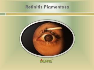 Retinitis Pigmentosa: Causes, Symptoms, Daignosis, Prevention and Treatment