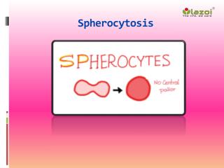Spherocytosis: Causes, Symptoms, Daignosis, Prevention and Treatment