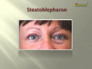 Steatoblepharon: Causes, Symptoms, Daignosis, Prevention and Treatment