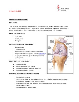 Joint Replacement in Pune| Knee Surgery | Dr Anshu Sachdev