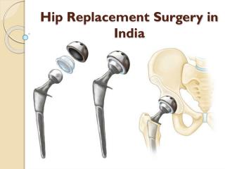Cost of hip replacement Surgery in India