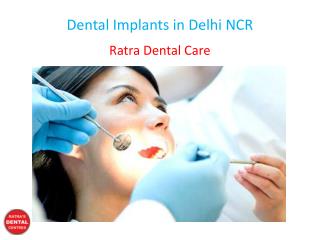 Dental Implants in Delhi NCR