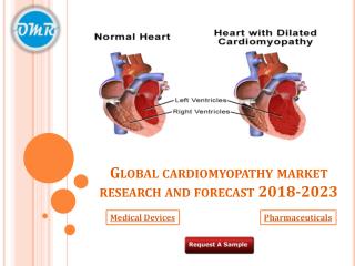 Cardiomyopathy Market