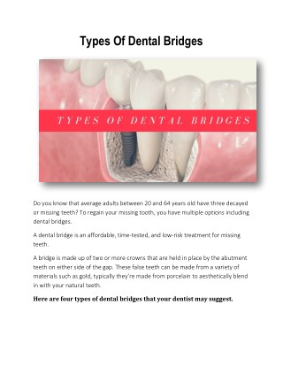 Types Of Dental Bridges