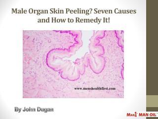 Male Organ Skin Peeling? Seven Causes and How to Remedy It!