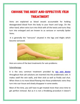 Choose The Best and Effective Vein Treatment