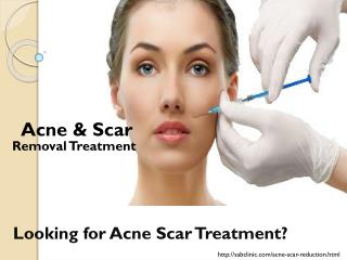 Acne & Scar Removal Treatment in Gurgaon