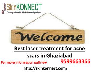 Best laser treatment for acne scars in Ghaziabad