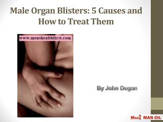 Male Organ Blisters: 5 Causes and How to Treat Them