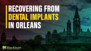 Recovering from Dental Implants in Orleans