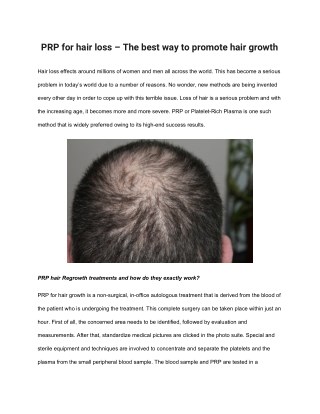 PRP for hair loss â€“ The best way to promote hair growth