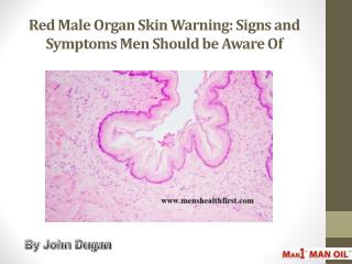 Red Male Organ Skin Warning: Signs and Symptoms Men Should be Aware Of