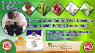 How to Stop Painful Piles Bleeding, Hemorrhoids Herbal Treatment?