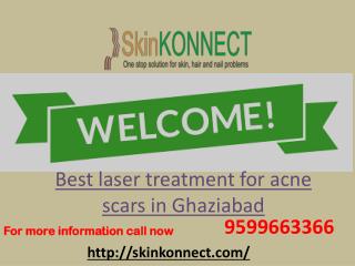 Best laser treatment for acne scars in Ghaziabad 9599663366.