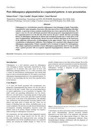 Post chikungunya pigmentation in a segmental pattern: A rare presentation