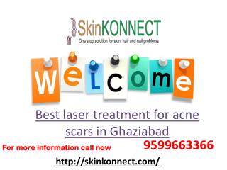 Here is solution for your skin problem best laser treatment for acne scars in ghaziabad 9599663366.