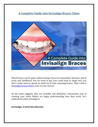 A Complete Guide into Invisalign Braces Chino