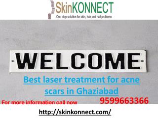 Best laser treatment for acne scars in Ghaziabad can call us 9599663366.